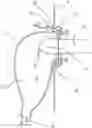 Fig. 01 - URETHRAL CATHETERIZATION STRUCTURE