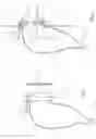 Fig. 04 - URETHRAL CATHETERIZATION STRUCTURE