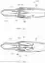 Fig. 05 - Vitrectomy probe interfacing component