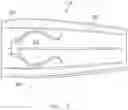 Fig. 06 - Vitrectomy probe interfacing component