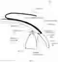 Fig. 02 - Device for treating glaucoma