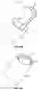 Fig. 14 - Ophthalmic knife and methods of use