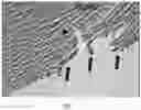 Fig. 02 - Intraocular device for dual incisions