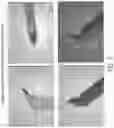 Fig. 06 - Intraocular device for dual incisions