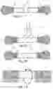 Fig. 11 - SWAB ASSEMBLY AND SYSTEM