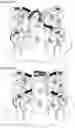 Fig. 15 - Motorized rehabilitation device