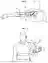 Fig. 04 - Exoskeleton structure adapted to the shoulder