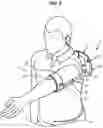 Fig. 05 - Exoskeleton structure adapted to the shoulder