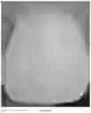Fig. 27 - Oral care compositions for active agent delivery