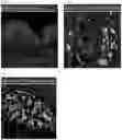Fig. 06 - Systemic Delivery of Polypeptides