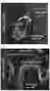 Fig. 08 - Systemic Delivery of Polypeptides