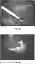 Fig. 09 - Bioerodible polyester polymer axitinib ocular implants and related methods of use