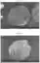 Fig. 11 - METHOD FOR MANUFACTURING DRUG-CONTAINING PARTICLES