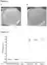 Fig. 08 - Pathogenic bacteria