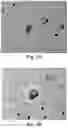 Fig. 04 - TREATMENT OF CANCER