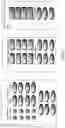 Fig. 05 - Methods of treating virally associated cancers with histone deacetylase inhibitors
