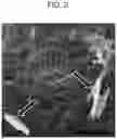 Fig. 03 - NANOCARRIERS AND THEIR PROCESSING FOR DIAGNOSTICS AND THERAPEUTICS