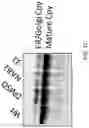 Fig. 04 - METHOD OF TREATING NEURODEGENERATIVE DISORDERS BY RESCUING ALPHA-SYNUCLEIN TOXICITY