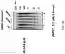 Fig. 11 - METHOD OF TREATING NEURODEGENERATIVE DISORDERS BY RESCUING ALPHA-SYNUCLEIN TOXICITY