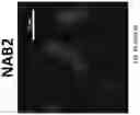 Fig. 24 - METHOD OF TREATING NEURODEGENERATIVE DISORDERS BY RESCUING ALPHA-SYNUCLEIN TOXICITY