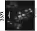Fig. 25 - METHOD OF TREATING NEURODEGENERATIVE DISORDERS BY RESCUING ALPHA-SYNUCLEIN TOXICITY