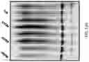 Fig. 33 - METHOD OF TREATING NEURODEGENERATIVE DISORDERS BY RESCUING ALPHA-SYNUCLEIN TOXICITY