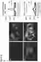 Fig. 49 - THREE-DIMENSIONAL DIFFERENTIATION OF EPIBLAST SPHEROIDS TO KIDNEY ORGANOIDS MODELS STAGE-SPECIFIC EPITHELIAL PHYSIOLOGY, MORPHOGENESIS, AND DISEASE