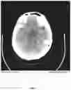 Fig. 08 - Systems and methods for determining ring artifact