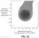 Fig. 09 - Method and apparatus for rapidly classifying defects in subcomponents of manufactured component