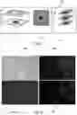 Fig. 04 - MEDICAL IMAGE DETECTION