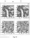 Fig. 05 - MEDICAL IMAGE DETECTION