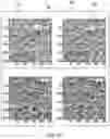 Fig. 06 - MEDICAL IMAGE DETECTION