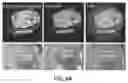 Fig. 10 - Systems and methods for integrating tomographic image reconstruction and radiomics using neural networks