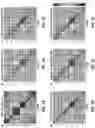 Fig. 06 - Atlas registration for resting state network mapping in patients with brain tumors