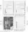 Fig. 12 - Methods and systems for characterizing fluids from a patient