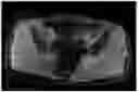Fig. 01 - System and method for automatic segmentation of muscles from high-resolution MRI using 3D deep convolutional neural network