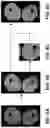 Fig. 06 - System and method for automatic segmentation of muscles from high-resolution MRI using 3D deep convolutional neural network