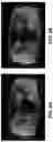 Fig. 07 - System and method for automatic segmentation of muscles from high-resolution MRI using 3D deep convolutional neural network