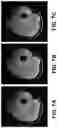Fig. 08 - System and method for automatic segmentation of muscles from high-resolution MRI using 3D deep convolutional neural network