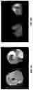 Fig. 09 - System and method for automatic segmentation of muscles from high-resolution MRI using 3D deep convolutional neural network