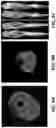 Fig. 10 - System and method for automatic segmentation of muscles from high-resolution MRI using 3D deep convolutional neural network