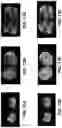 Fig. 14 - System and method for automatic segmentation of muscles from high-resolution MRI using 3D deep convolutional neural network