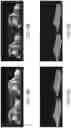 Fig. 09 - ONLINE LEARNING FOR 3D POSE ESTIMATION