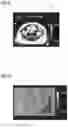 Fig. 04 - Generating a quantitative parameter map from magnetic resonance (MR) data
