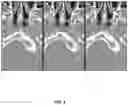 Fig. 09 - Method and system for improving CT image quality
