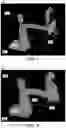 Fig. 05 - Embedding complex 3D objects into an augmented reality scene using image segmentation