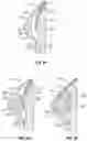 Fig. 08 - Breast and abdominal augmentation and reconstruction teaching model