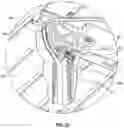 Fig. 45 - ANTENNA APPARATUS HAVING CHASSIS PORTION