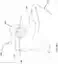 Fig. 02 - DEPLOYABLE BALLOON ILLUMINATION FOR ENDOSCOPY
