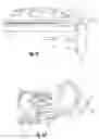 Fig. 06 - Installable RF coil assembly